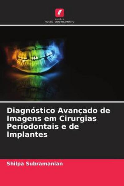 Diagnóstico Avançado de Imagens em Cirurgias Periodontais e de Implantes