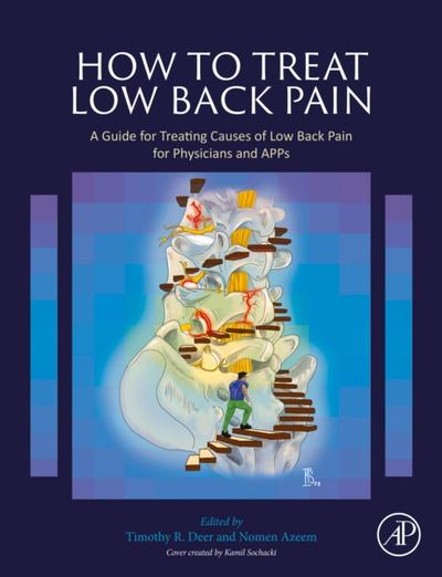How to Treat Low Back Pain