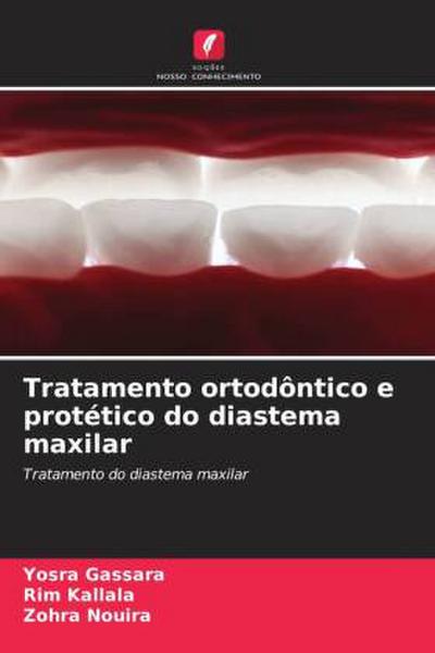 Tratamento ortodôntico e protético do diastema maxilar