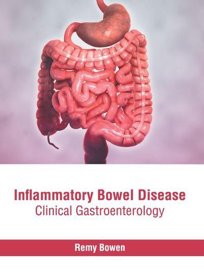 Inflammatory Bowel Disease: Clinical Gastroenterology