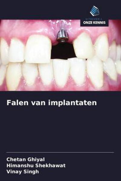 Falen van implantaten