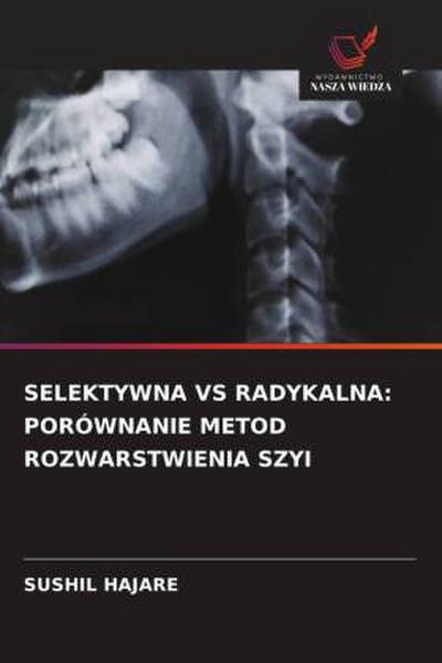 SELEKTYWNA VS RADYKALNA: PORÓWNANIE METOD ROZWARSTWIENIA SZYI
