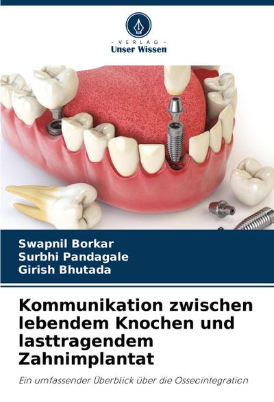 Kommunikation zwischen lebendem Knochen und lasttragendem Zahnimplantat