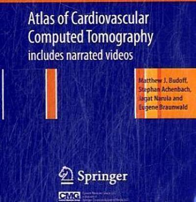 Atlas of Cardiovascular Computed Tomography