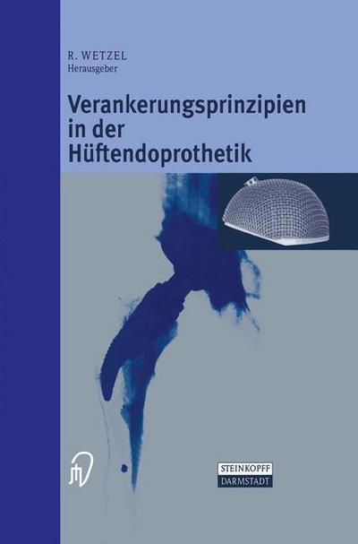 Verankerungsprinzipien in der Hüftendorprothetik