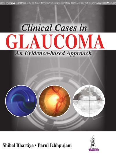 CLINICAL CASES IN GLAUCOMA AN EVIDENCE-BASED APPROACH