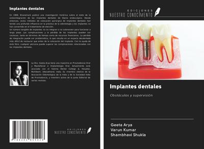 Implantes dentales