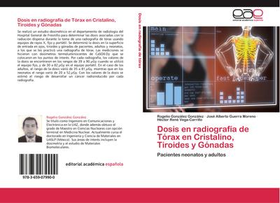 Dosis en radiografía de Tórax en Cristalino, Tiroides y Gónadas