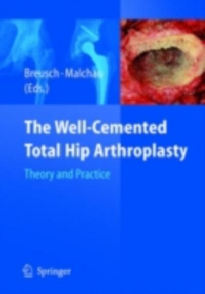 The Well-Cemented Total Hip Arthroplasty