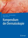 Kompendium der Dermatoskopie