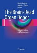 The Brain-Dead Organ Donor