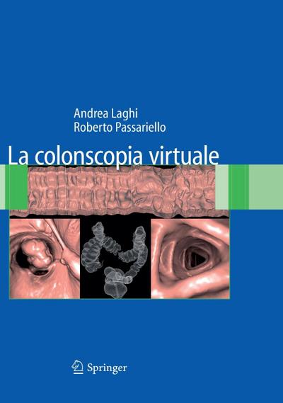 La Colonscopia Virtuale