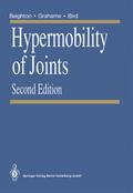 Hypermobility of Joints
