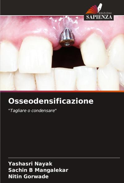 Osseodensificazione