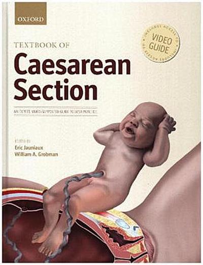 Textbook of Caesarean Section