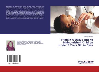 Vitamin A Status among Malnourished Children under 5 Years Old in Gaza