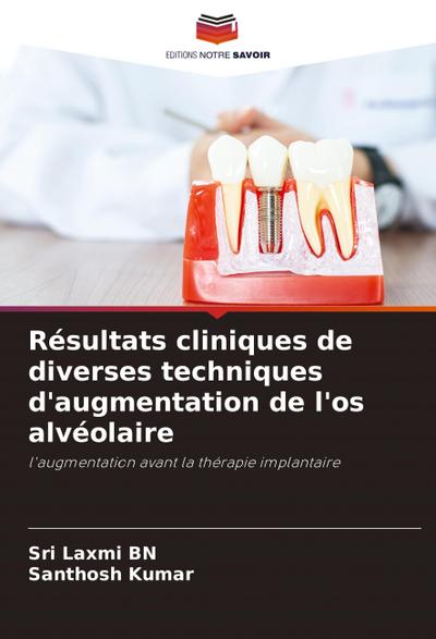 Résultats cliniques de diverses techniques d’augmentation de l’os alvéolaire