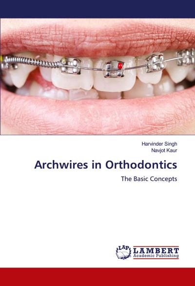 Archwires in Orthodontics