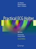 Practical ECG Holter