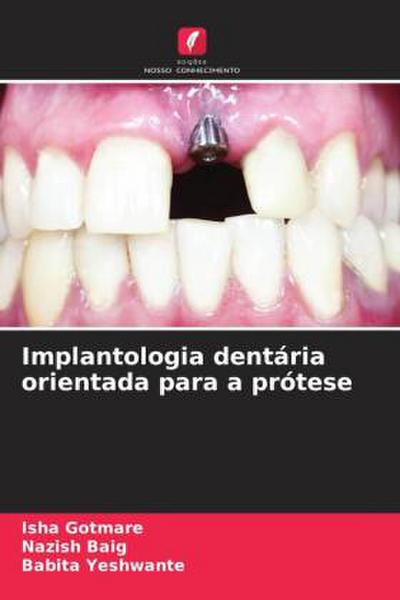 Implantologia dentária orientada para a prótese