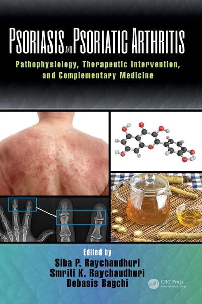 Psoriasis and Psoriatic Arthritis