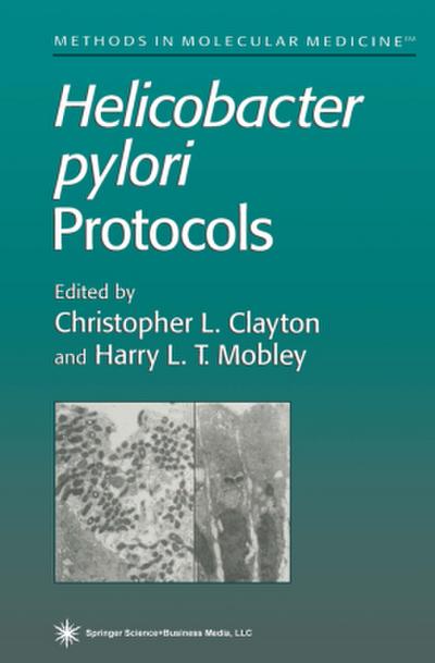 Helicobacter Pylori Protocols