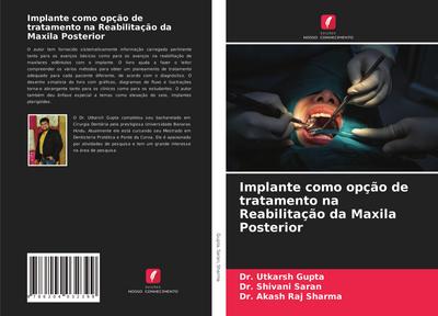Implante como opção de tratamento na Reabilitação da Maxila Posterior