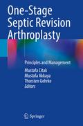 One-Stage Septic Revision Arthroplasty