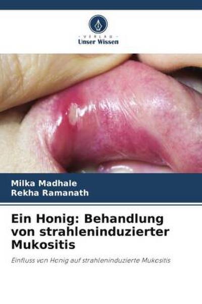 Ein Honig: Behandlung von strahleninduzierter Mukositis