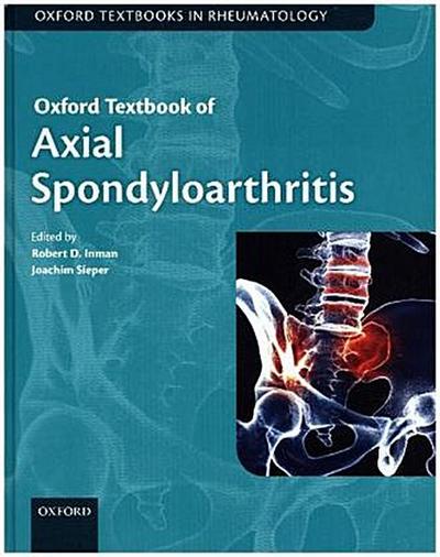 Oxford Textbook of Axial Spondyloarthritis