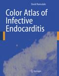 Color Atlas of Infective Endocarditis