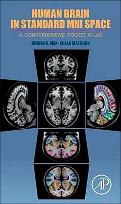 Human Brain in Standard Mni Space