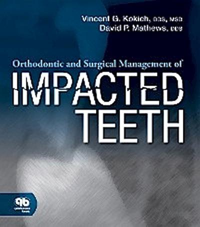 Orthodontic and Surgical Management of Impacted Teeth
