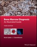 Bone Marrow Diagnosis