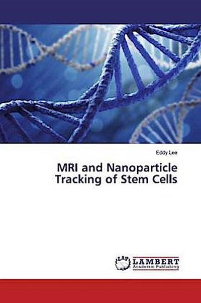 MRI and Nanoparticle Tracking of Stem Cells