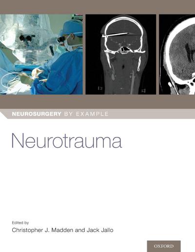Neurotrauma