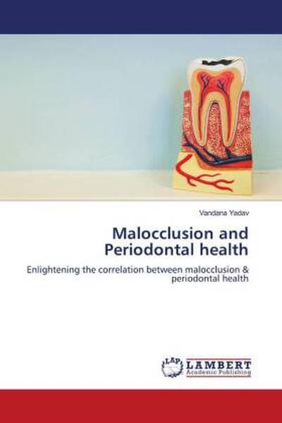Malocclusion and Periodontal health