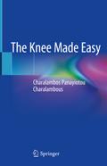 The Knee Made Easy