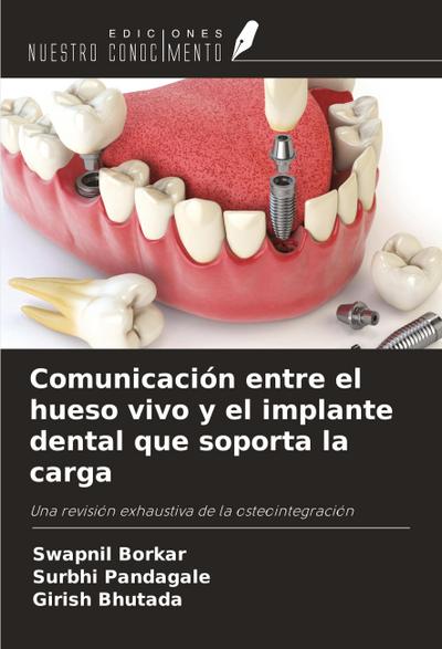 Comunicación entre el hueso vivo y el implante dental que soporta la carga