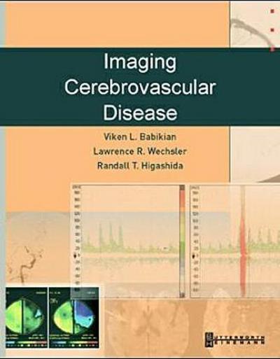 Imaging Cerebrovascular Disease - Viken L. Babikian, Randall Higashida, Lawrence R. Wechsler