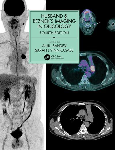 Husband & Reznek’s Imaging in Oncology