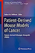 Patient-Derived Mouse Models of Cancer