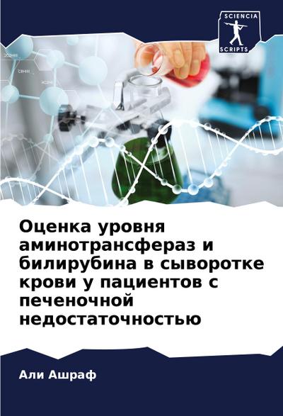Ocenka urownq aminotransferaz i bilirubina w syworotke krowi u pacientow s pechenochnoj nedostatochnost’ü