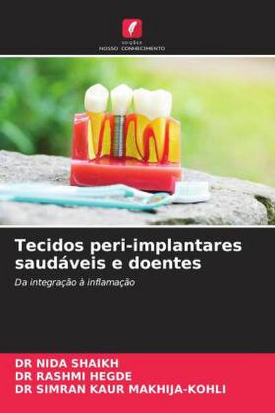 Tecidos peri-implantares saudáveis e doentes