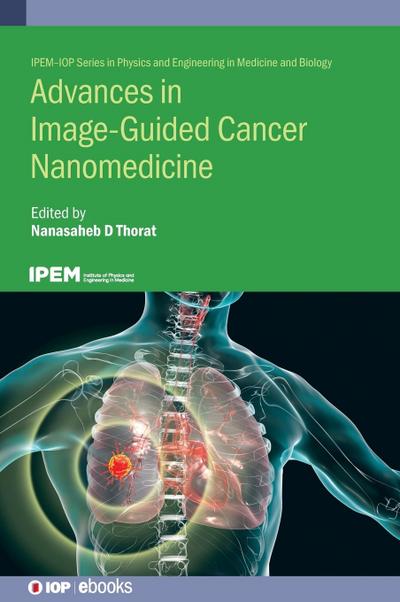 Advances in Image-Guided Cancer Nanomedicine