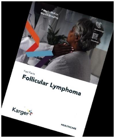 Fast Facts: Follicular Lymphoma