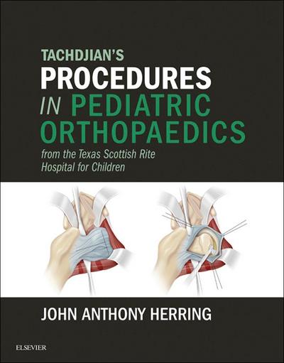 Tachdjian’s Procedures in Pediatric Orthopaedics