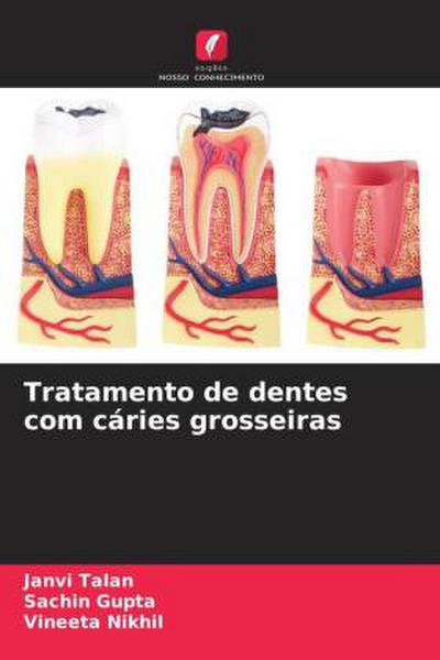 Tratamento de dentes com cáries grosseiras