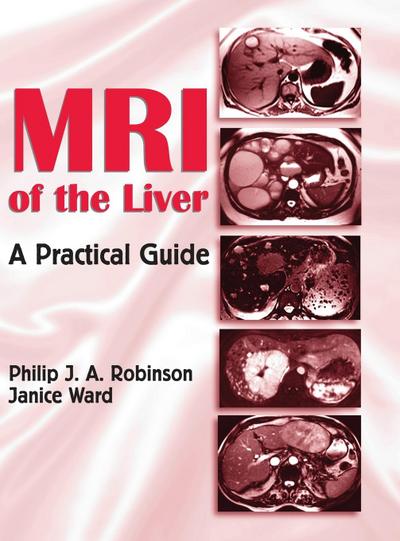 MRI of the Liver