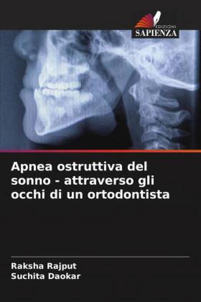 Apnea ostruttiva del sonno - attraverso gli occhi di un ortodontista